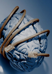brain wrapped with network cables